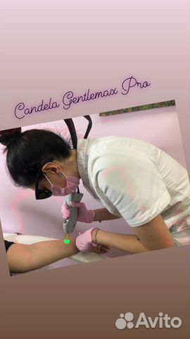 Лазерная эпиляция candela.Александритовый лазер Лазерная эпиляция candela.Александритовый лазер